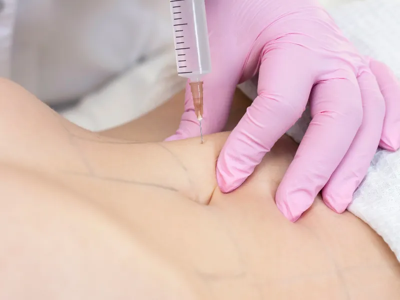 Weight Loss Injections Orange County