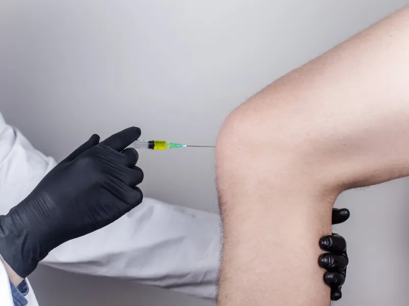 spider vein treatment before and after