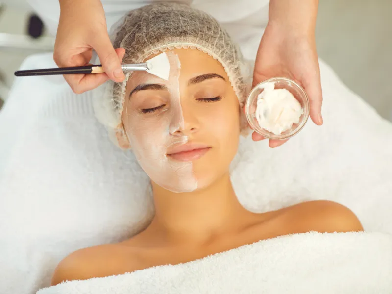 vi peel reviews