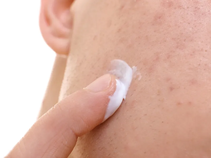 benefits of this murad acne treatment