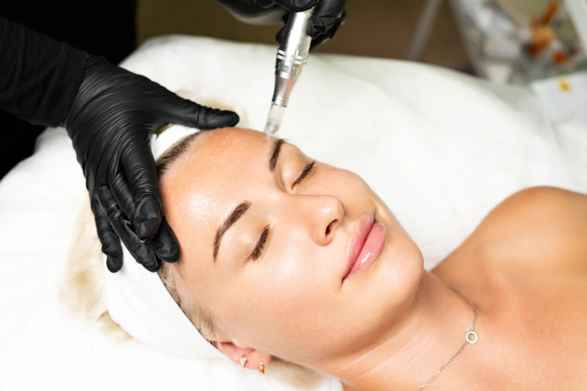 rf microneedling benefits
